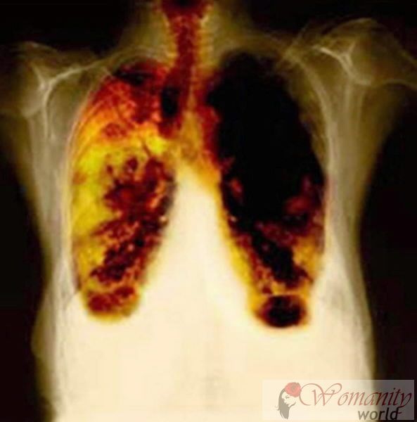 Test ein Medikament, das die Entwicklung von Lungenkrebs verlangsamt