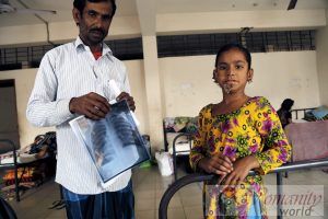 Een meisje in Bangladesh, nieuwe getroffen door de zeldzame ziekte 