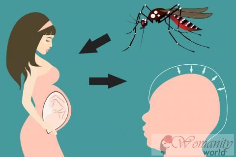 Virus Zika et microcéphalie