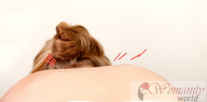 Akupunktur kann Hitzewallungen der Menopause entlasten.