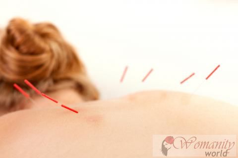 Akupunktur und Fruchtbarkeit