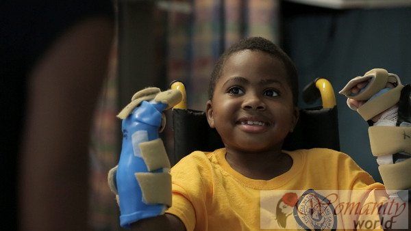 Zion Harvey, das erste Kind in der Welt eine Handtransplantation zu erhalten.