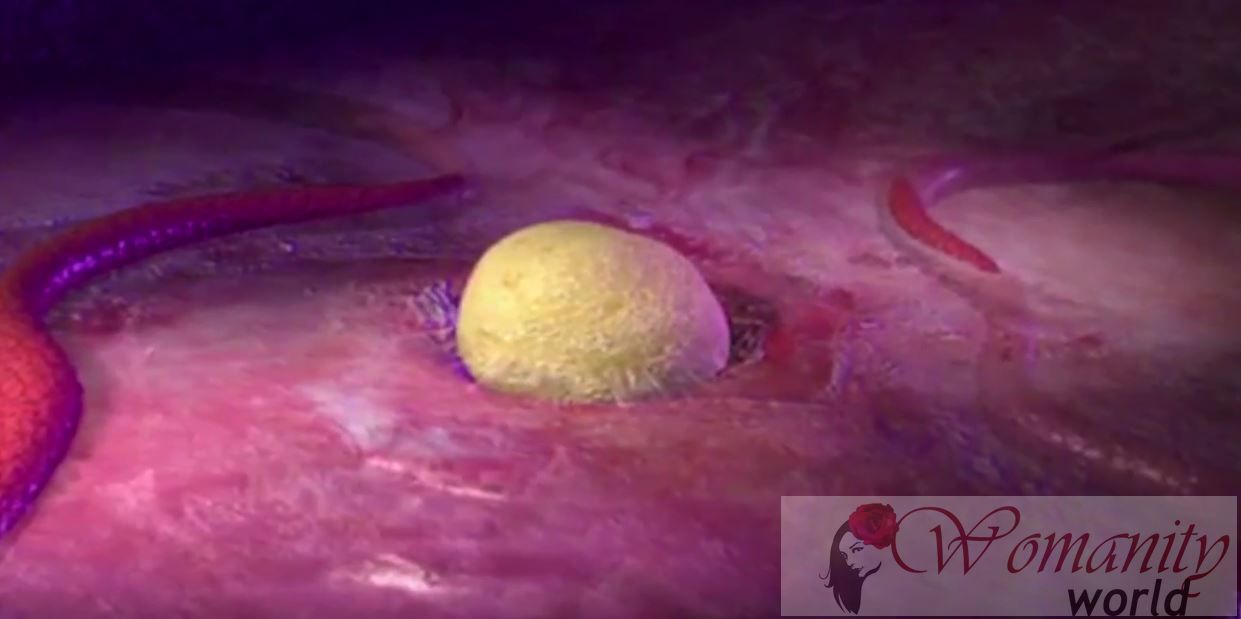 Cancer de l'ovaire avancé: la chirurgie pour compléter extirpadora prolongent la survie