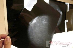 Ana Lluch: Bröstet tumörbiologi undviker onödig kemoterapi