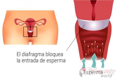 Påtagning och användning av vaginal membran