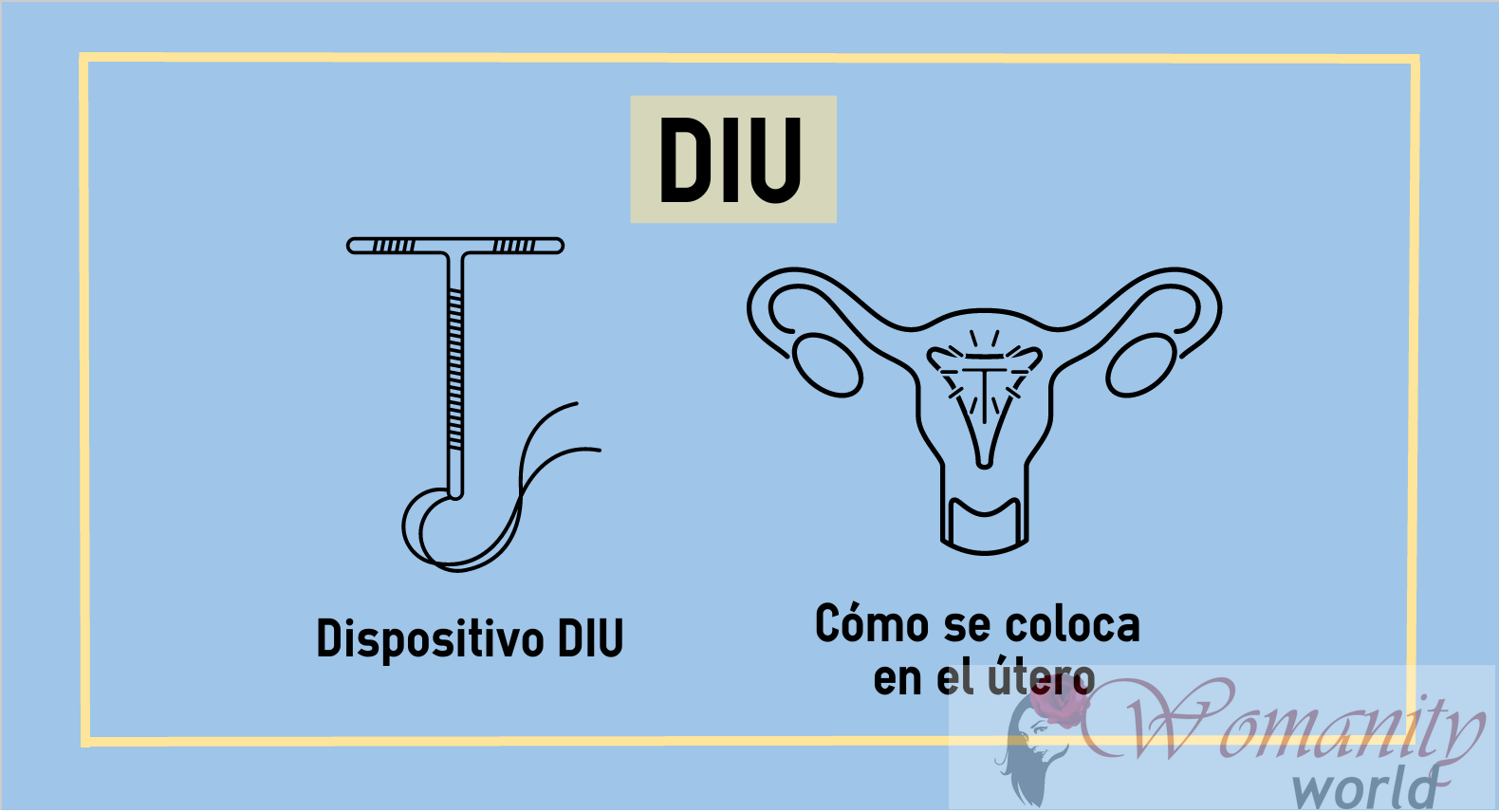 IUD, un sempre più comune per messicano scelta donne.